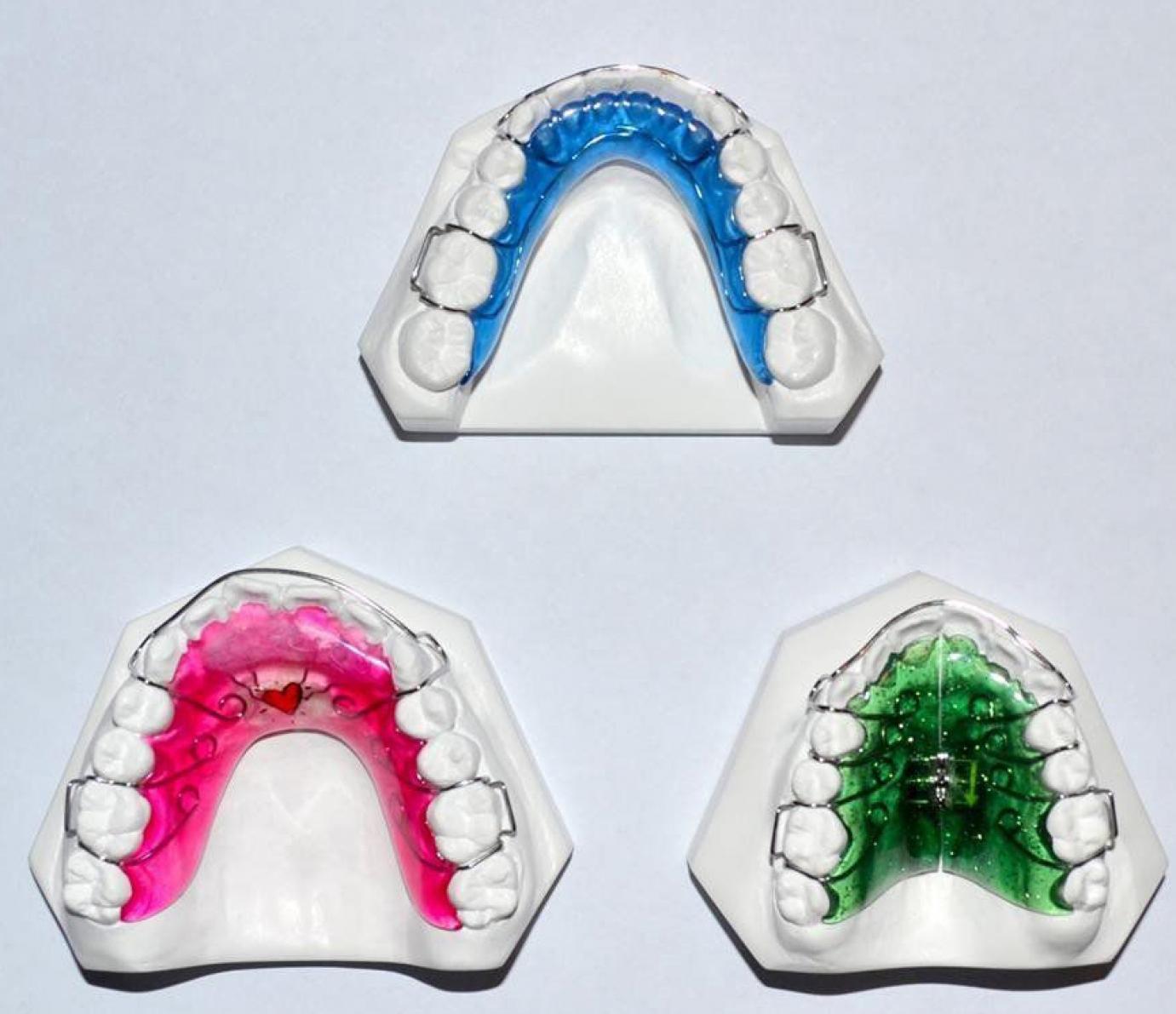 Fogszabályozó készülékek