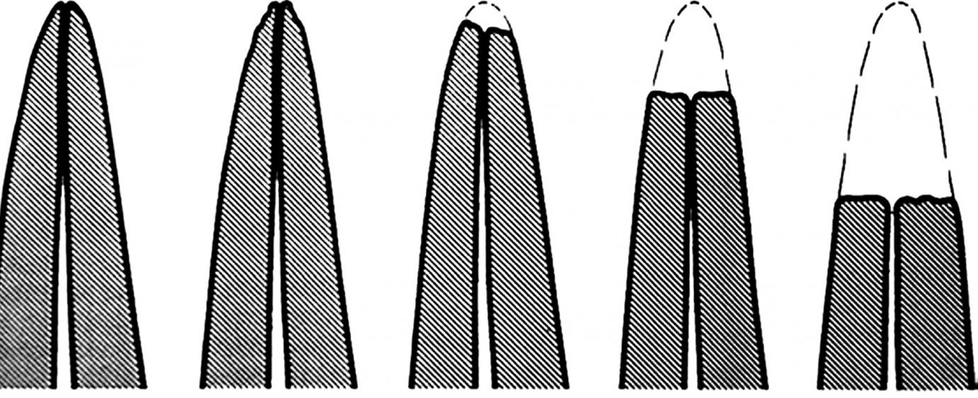 Gyökérfelszívódás