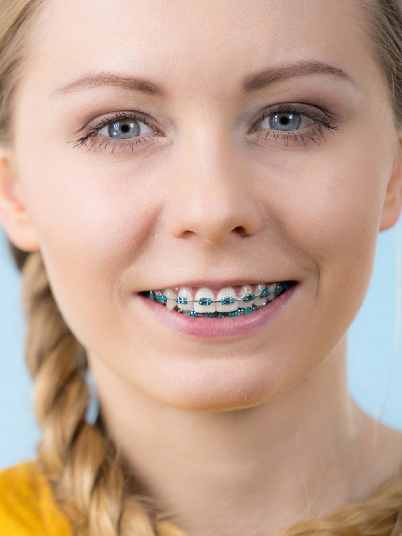 Felnőtt női mosoly