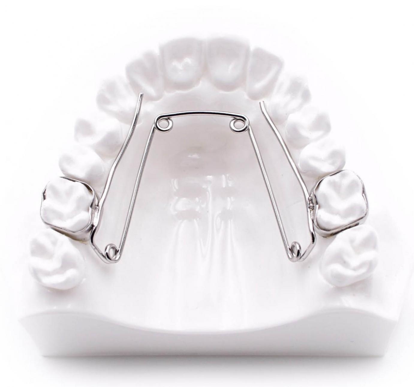 Quad helix fogszabályozó készülék