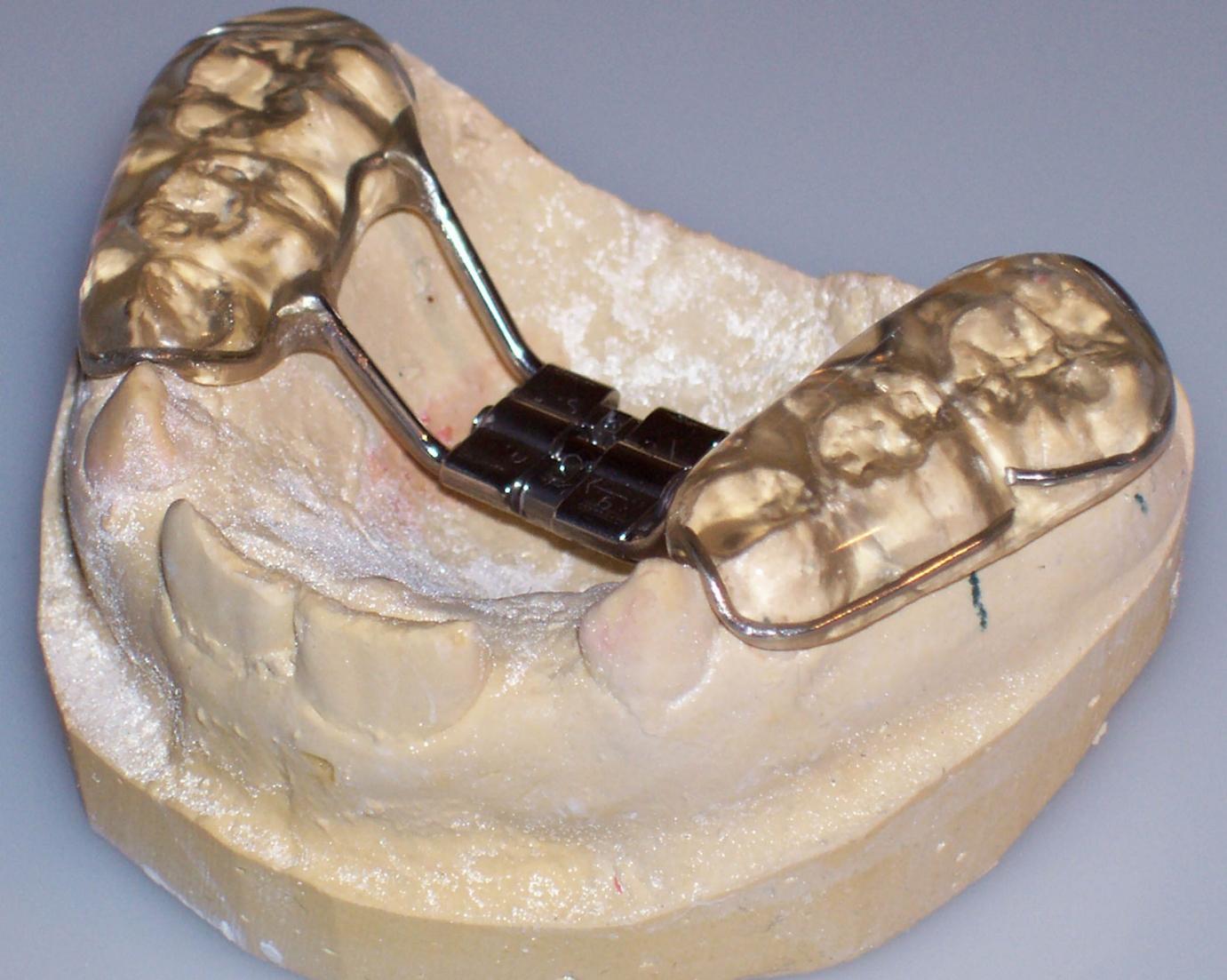 Splint Hyrax fogszabályozó készülék